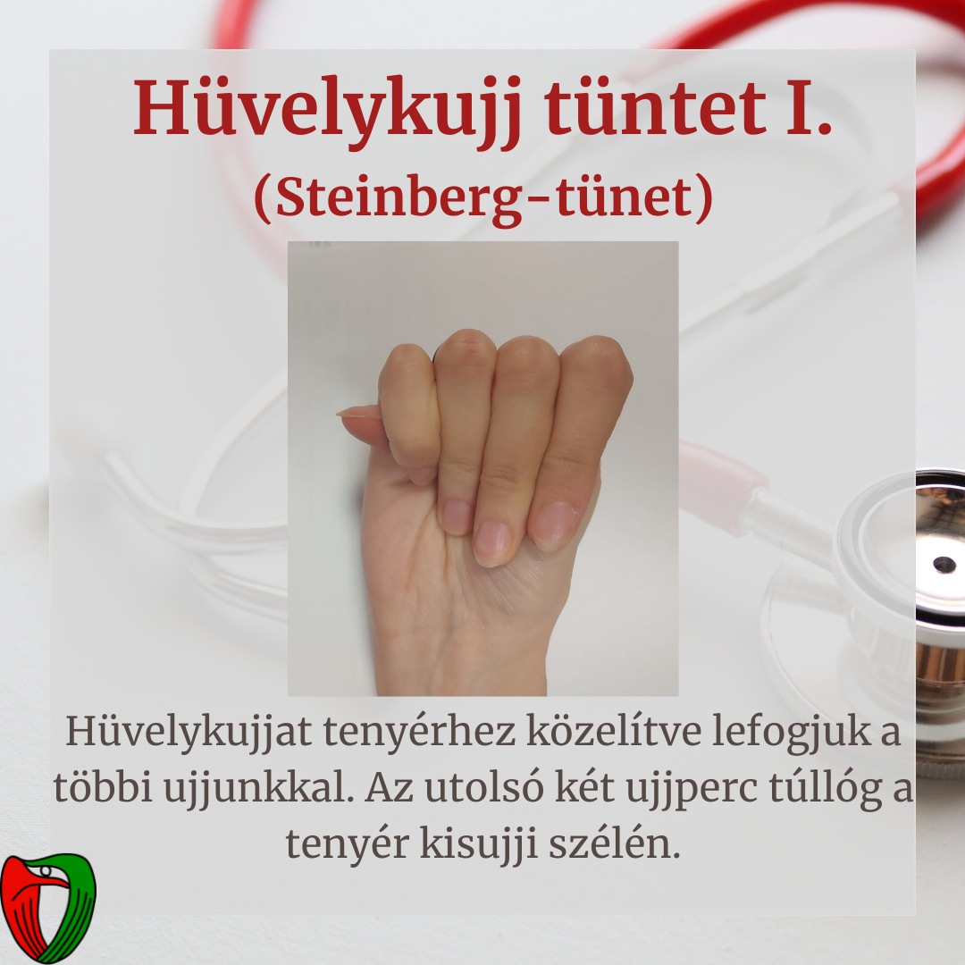 Betegknt s orvosknt is fontos felismerni olyan testi tneteket/fizikai adottsgokat, melyek jelenlte nagyban sszefgg a Marfan-szindrma megltvel.