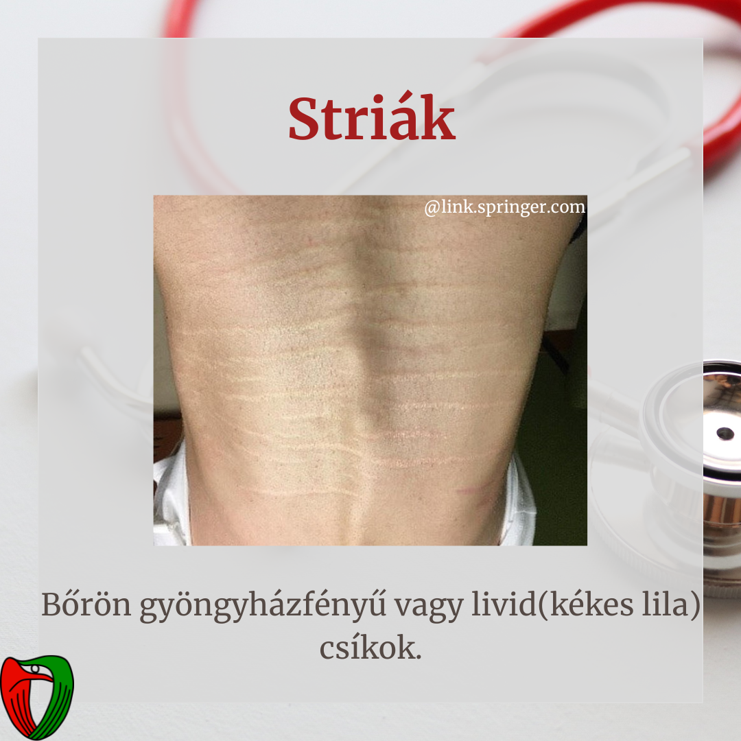 nvizsglat mellett elengedhetetlen a szakorvosi vizsglat, mely a Marfan Ambulancin trtnik!