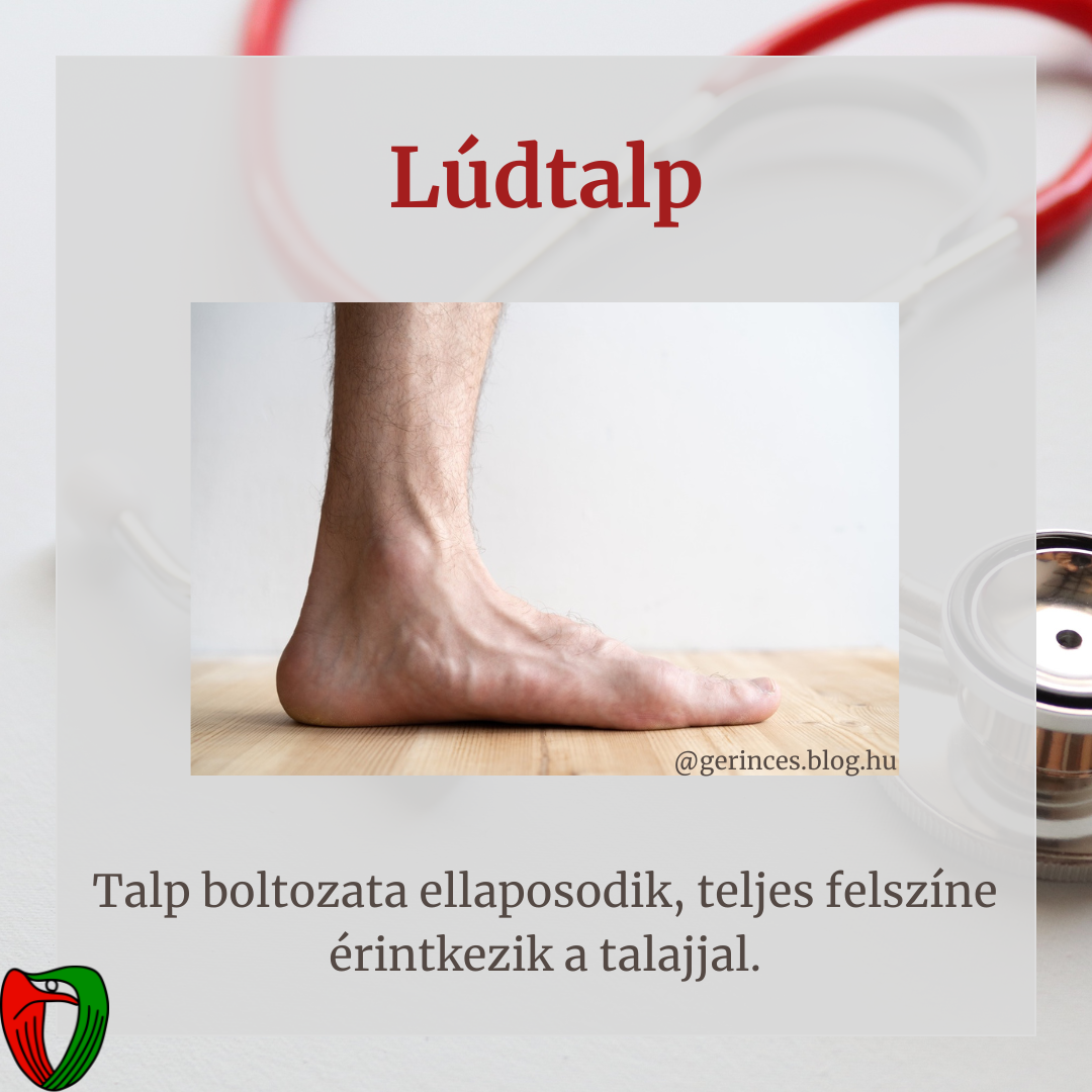 nvizsglat mellett elengedhetetlen a szakorvosi vizsglat, mely a Marfan Ambulancin trtnik!