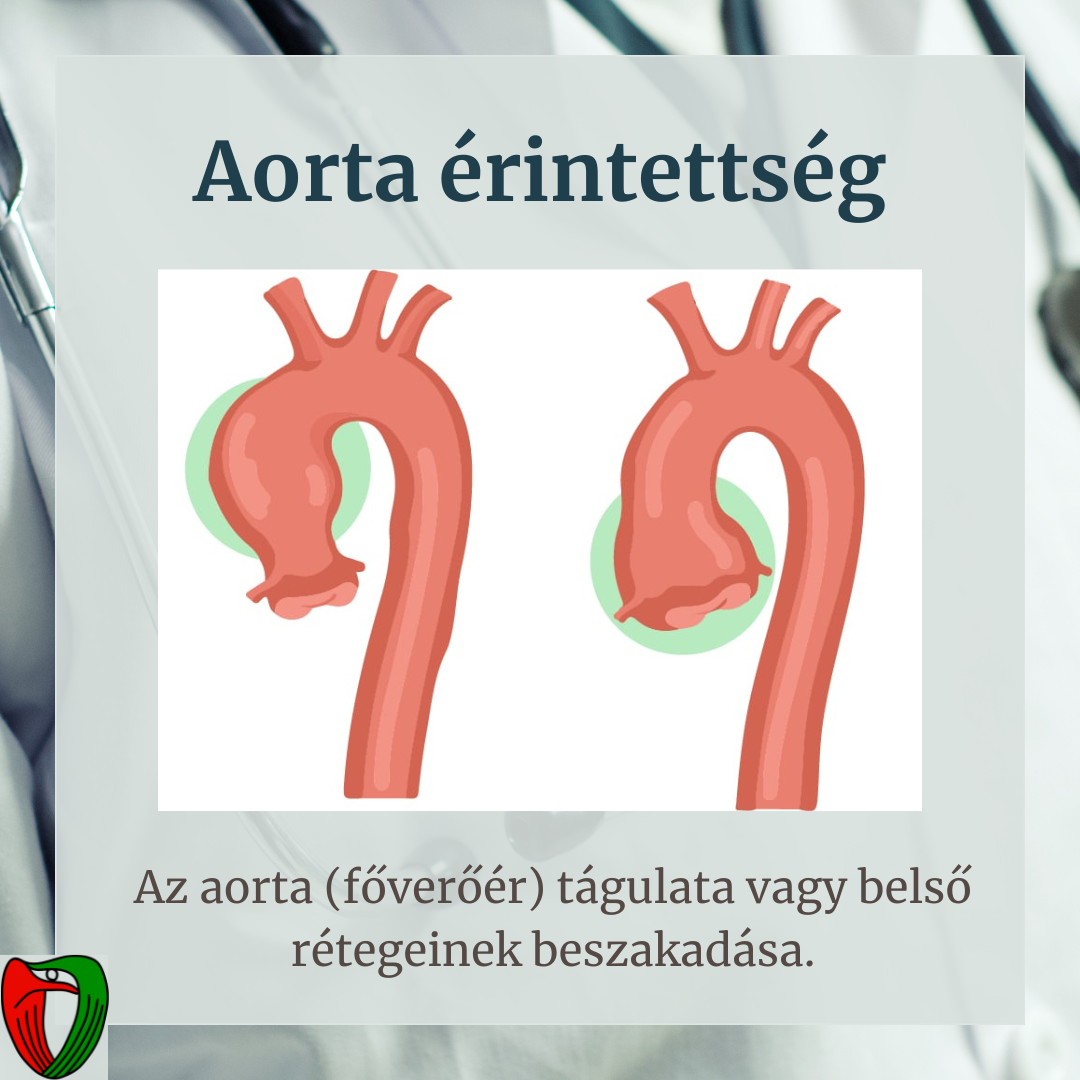 Mit nem l�thatunk?