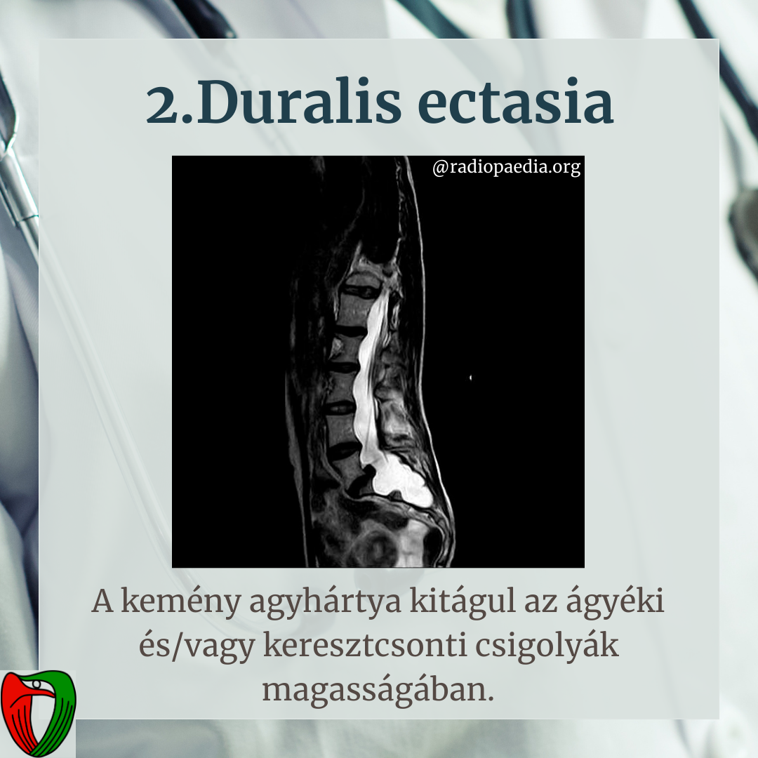 Ilyen esetben k�rj�k, b�tran keresse a Marfan Ambulanci�t!