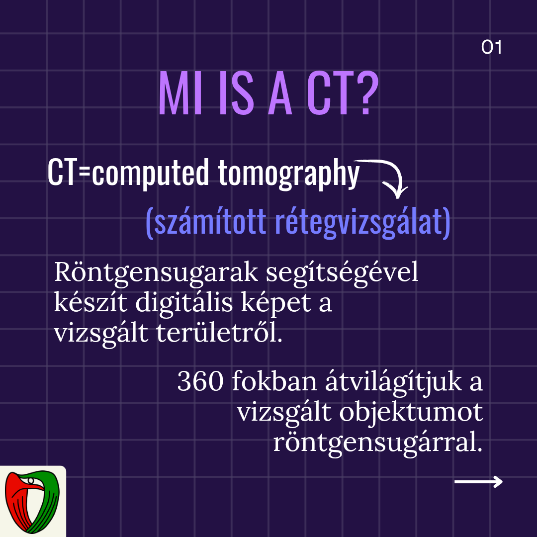 A CT egy sz�m�tott r�tegvizsg�lat, ahol r�ntgensugarak seg�ts�g�vel k�sz�thet�nk digit�lis k�pet a vizsg�lt ter�letekr�l. A r�ntgensugarakkal 360 fokban vil�g�tjuk �t az �szlelt objektumot.