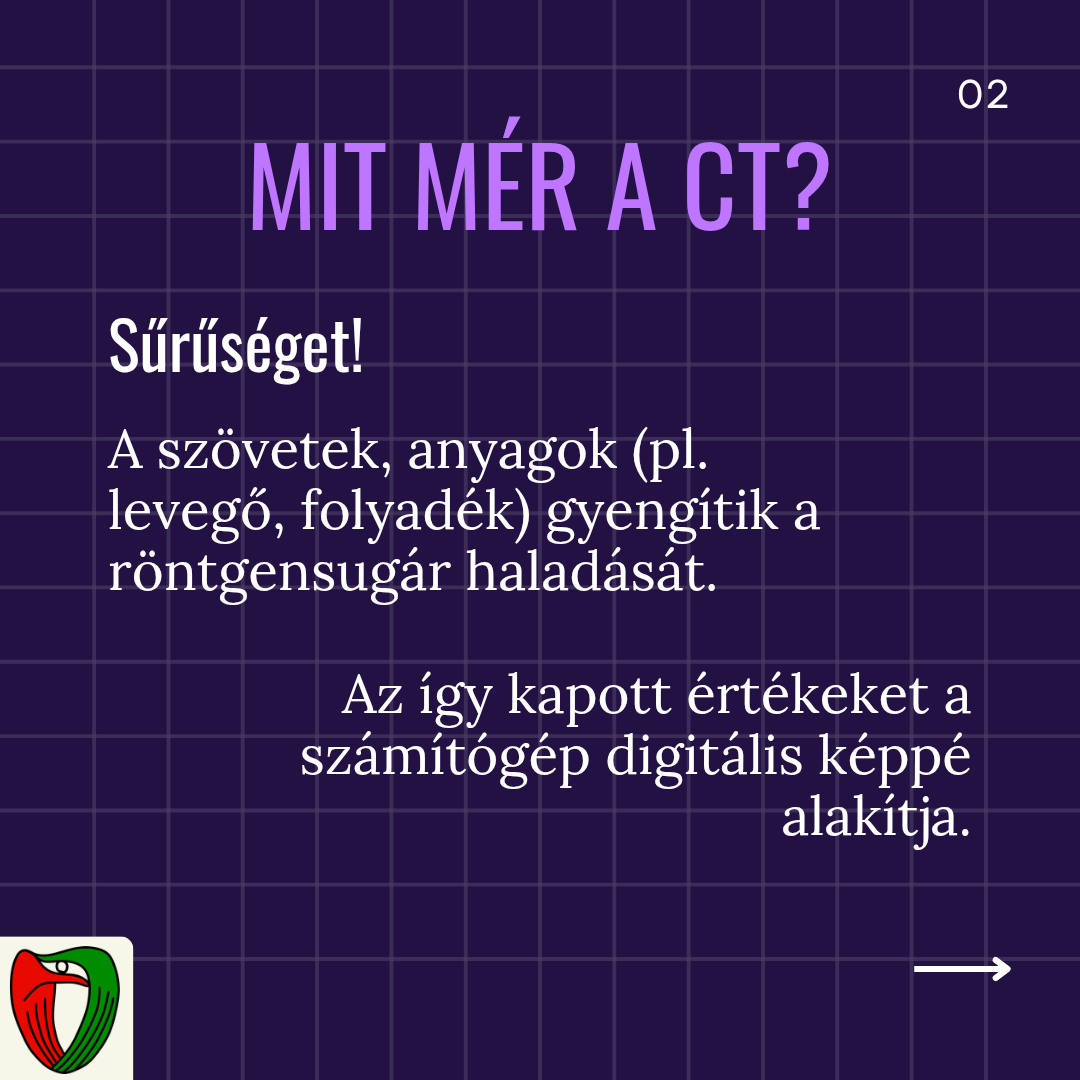 A CT vizsg�lat sor�n a sz�vetek vagy anyagok s�r�s�g�t �szleli az eszk�z, amely �rt�keket a sz�m�t�g�p digit�lis k�pp� alak�t.