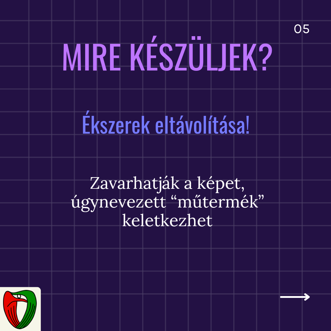 A legfontosabb tudnival� betegk�nt CT vizsg�lat el�tt, hogy el kell t�vol�tani minden olyan �kszert, amely f�mb�l k�sz�lt, mert ezek zavarhatj�k a r�szecsk�k �szlel�s�t, ezzel �gynevezett 