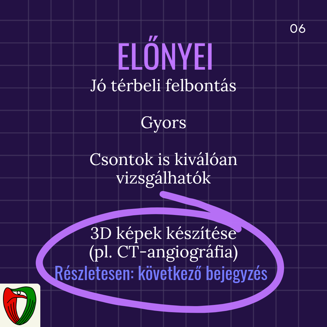 A CT el�nyei abban rejlenek, hogy j� t�rbeli felbont�st biztos�t, a vizsg�lat gyors, a csontrendszer is kiv�l�an vizsg�lhat� vele �s m�g 3 dimenzi�s felv�teleket is tudunk k�sz�teni a seg�ts�g�vel.