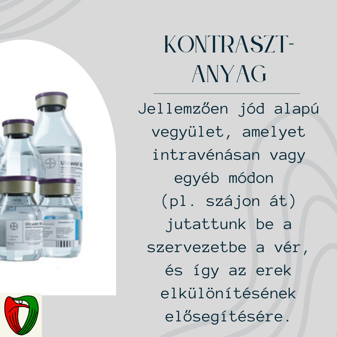 A kontrasztanyag egy olyan, jellemz�en j�d alap� vegy�let, ami el�seg�ti a v�r, �s �gy az erek elk�l�n�t�s�t a CT felv�telen. A kontrasztanyagot a szervezetbe juttatni t�bbf�le m�don lehet: CT angiogr�fia eset�n intrav�n�san, de p�ld�ul a belek vizsg�lata c�lj�b�l sz�jon �t t�rt�nik az adagol�s.