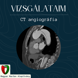 Vizsg�lataim: CT